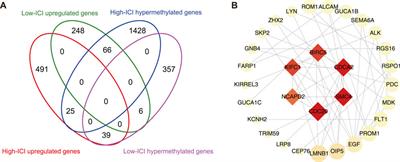 Comprehensive Analysis of the Immune Cell Infiltration Landscape and Immune-Related Methylation in Retinoblastoma